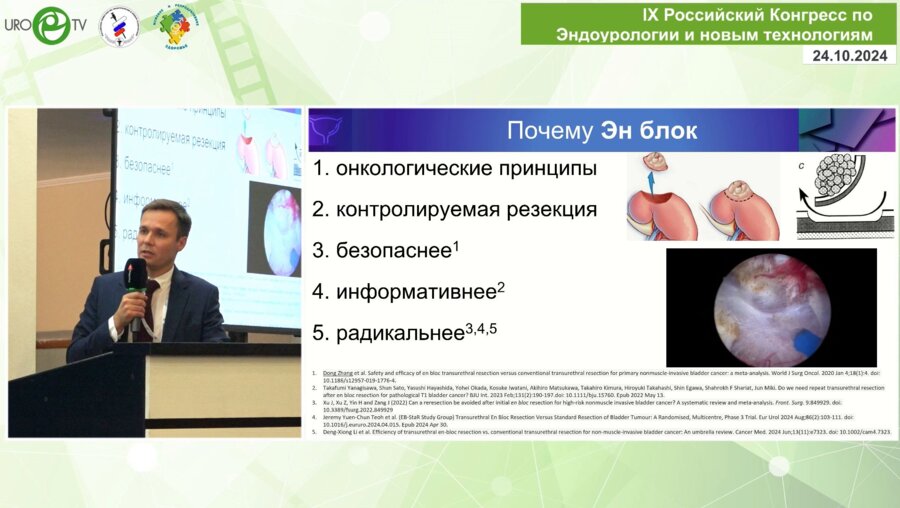 Кисляков Д.А. - ТВЛ в лечении рака мочевого пузыря