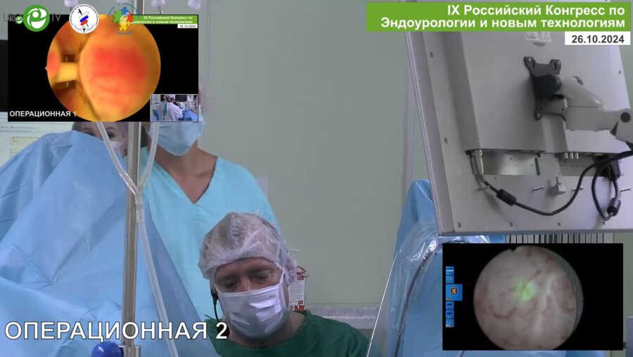 Болгов Е.Н. - Лазерная энуклеация ДГПЖ (лазер Lumenis)