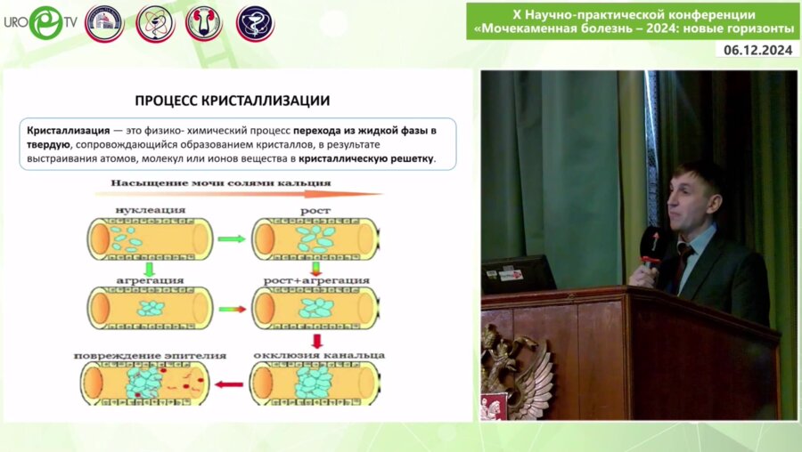 Войтко Д.А. - Возможности оценки антикристаллизационной активности мочи