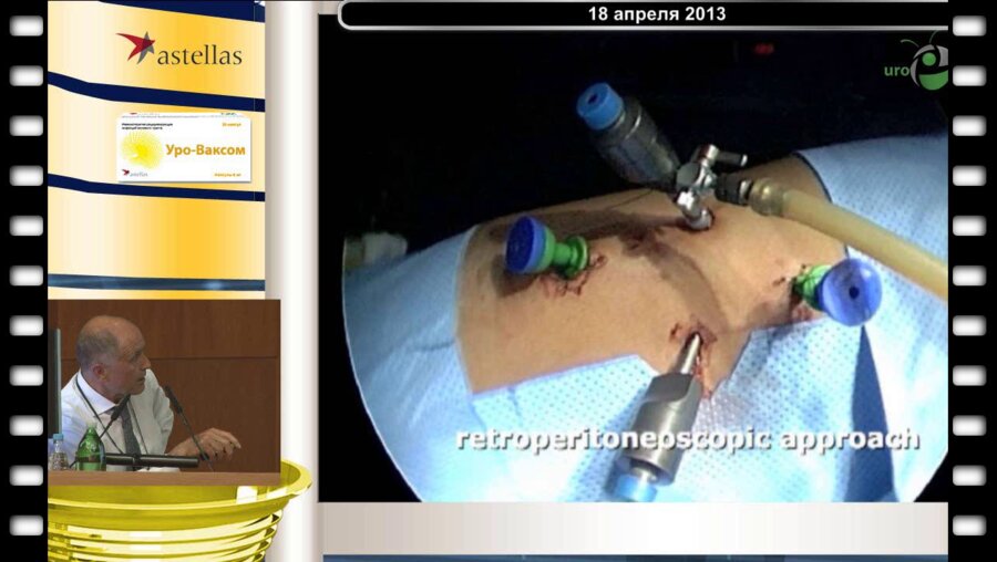 Valla J-S - Видеохирургические реконструктивно-пластические операции в детской урологии(Детская больница Lenval, Ницца, Франция) 