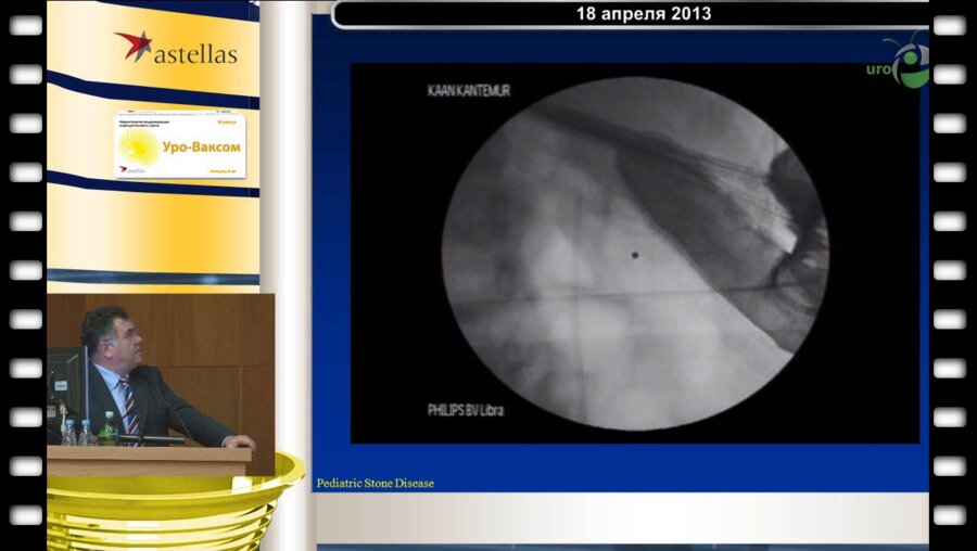 Тегюл С. - Малоинвазивные методы лечения мочекаменной болезни у детей (Университет Hacettepe, Анкара, Турция)