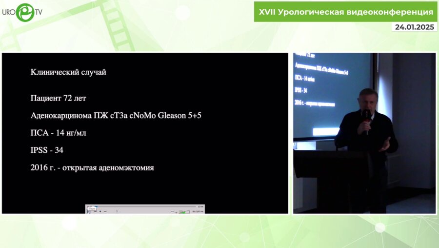 Моно П. - Использование современной робот-ассистированной комбинированной хирургии в сложных случаях