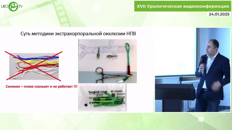 Петросян Г.С. - Методика экстракорпоральной окклюзии НПВ при тромбэктомии