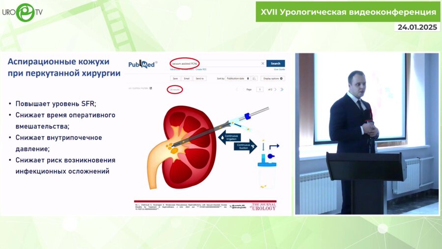 Сытник Д.А. - Применение аспирационных кожухов в лечении пациентов с мочекаменной болезнью
