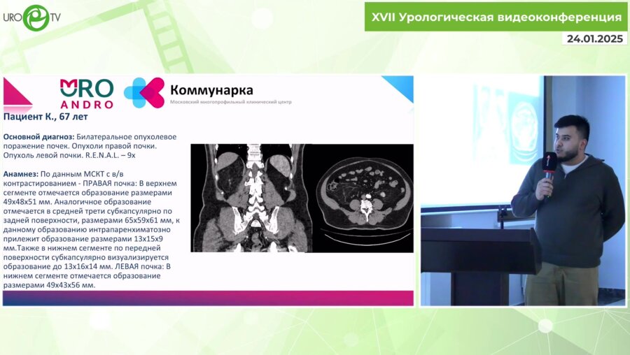 Тызьо Д.В. - Сложная резекция. R.E.N.A.L. 30+. Что бы это могло быть?