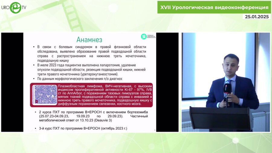 Исаев Т.К. - Аутотрансплантация почки в подвздошную область после комбинированного лечения лимфомы малого таза