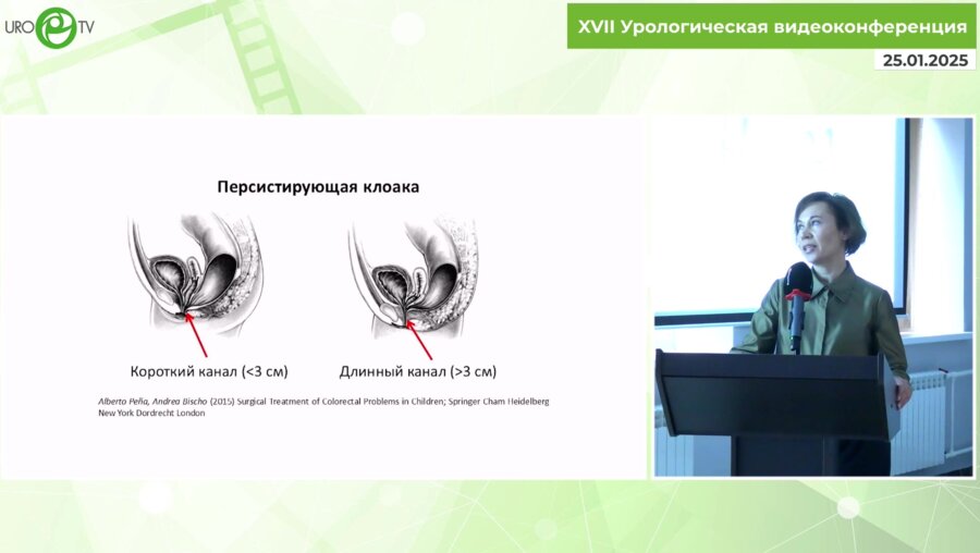 Петрухина Ю.В. - Формирование гетеротопического мочевого резервуара и реконструкция влагалища у пациентки с клоакой