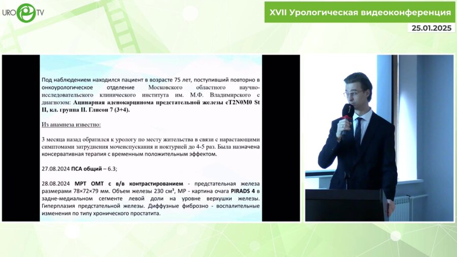 Подойницын А.А. - Наш опыт. Лапароскопическая простатэктомия объемом 230 см3