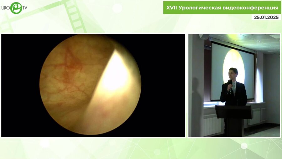 Степанченко В.С. - Лапароскопическая фистулопастика пузырно-влагалищного свища