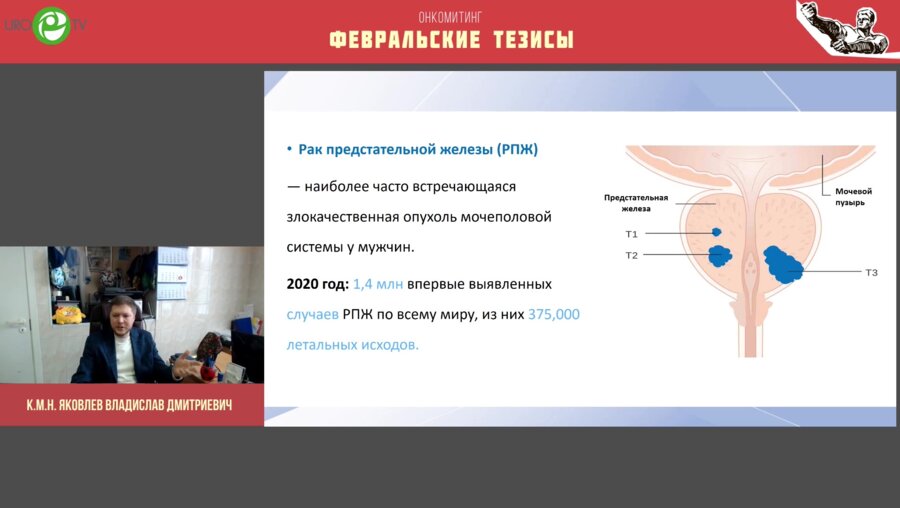 Яковлев В.Д. - Рецидив рака предстательной железы после лучевой терапии