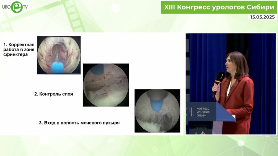 Лебедева А.А. - Реабилитация пациентов после операций на предстательной железе