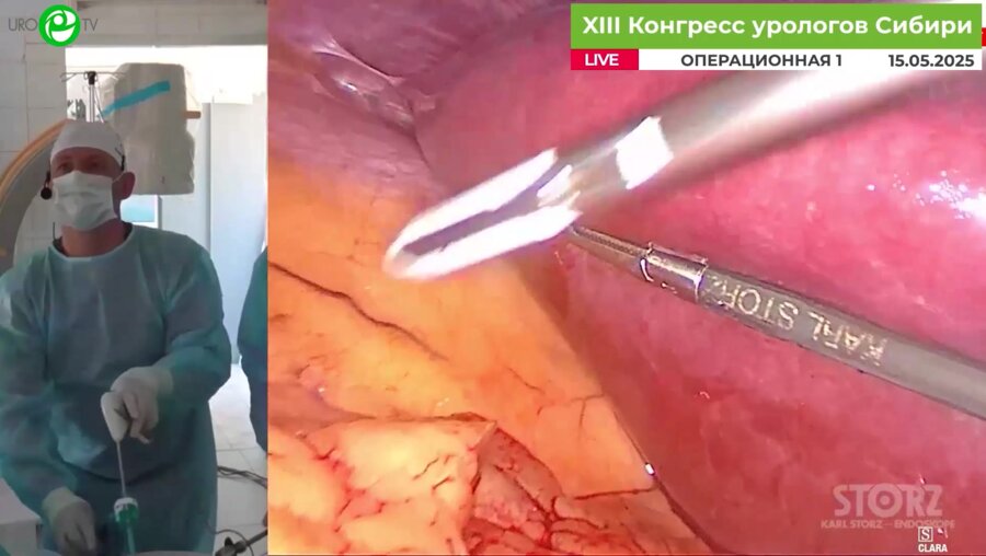 Новиков А.Б. - Лапароскопическая резекция правой почки