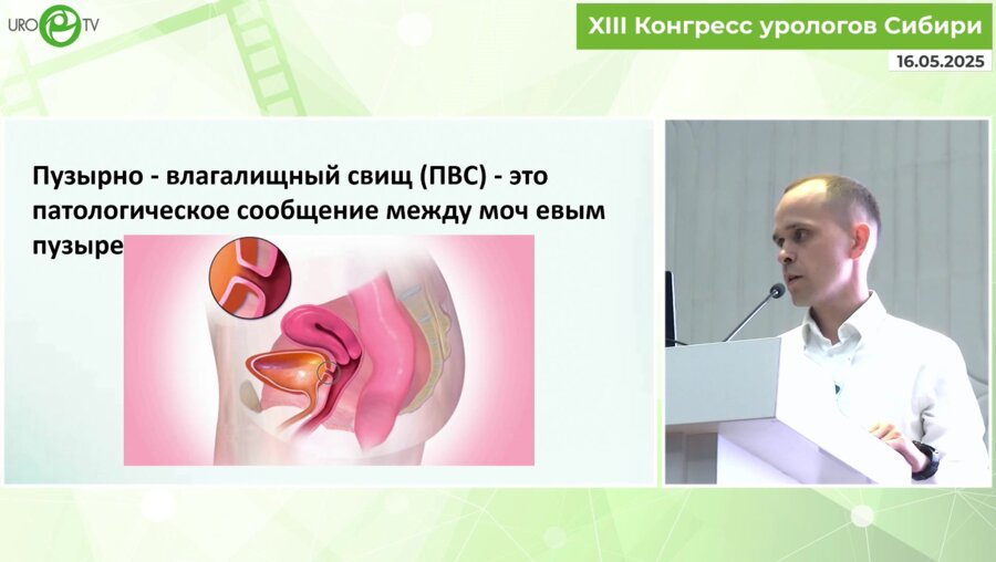 Дианов М.П. - Хирургическая реабилитация больных с постлучевыми пузырно-влагалищными свищами