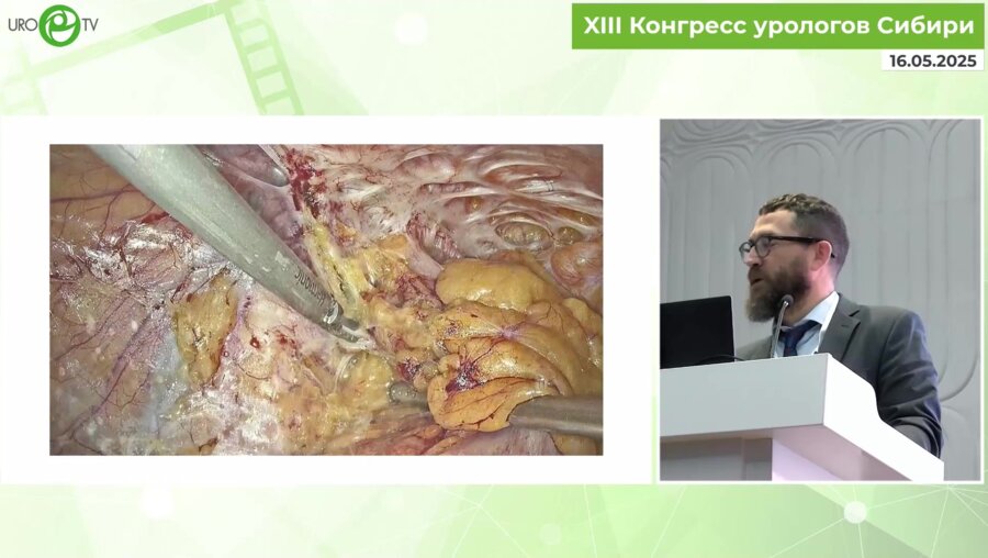 Холтобин Д.П. - Репростатэктомия