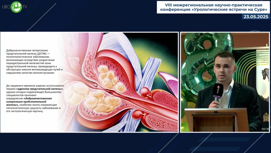 Байков Н.А. - СНМП при ДГПЖ, расставляем акценты
