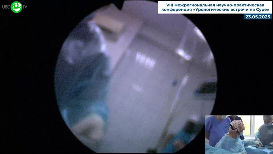Шкодкин С.В. - Тулиевая лазерная энуклеация предстательной железы