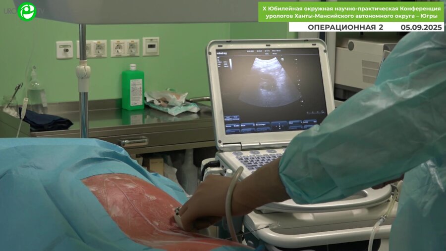 Новосёлов В.Г. - Миниперкутанная нефролитотрипсия