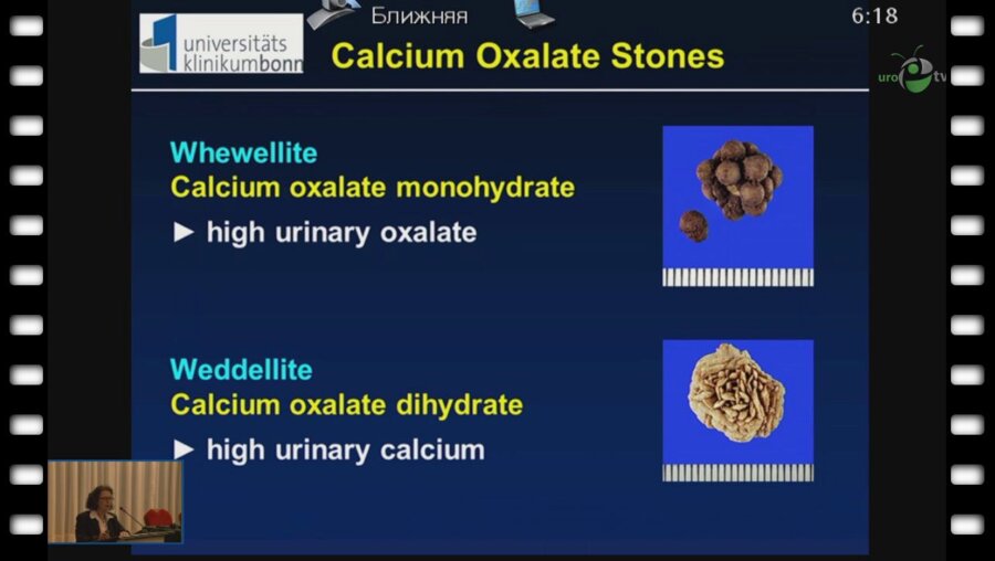 Siener R. - "Патогенетическая информация из анализа камней"