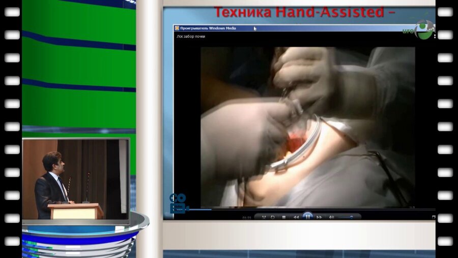 И.В. Феофилов - Лапароскопическая «донорская» нефрэктомия