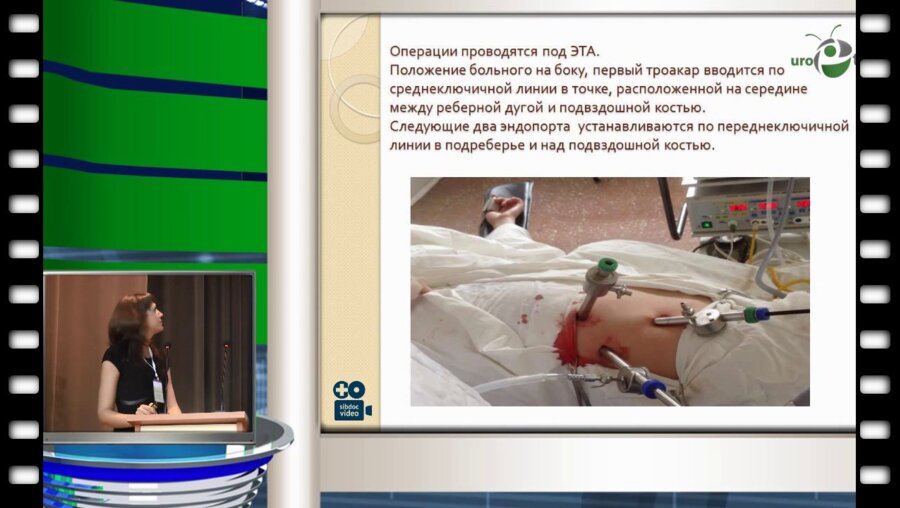 А.А. Вершинина - Люмбоскопические операции в лечении пациентов с острым обструктивным пиелонефритом на фоне мочекаменной болезни