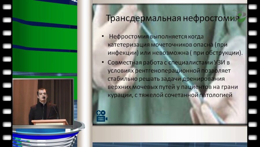 С.С. Мирошник - Возможности эндоскопической хирургии в городском научно-практическом центре клинической андрологии