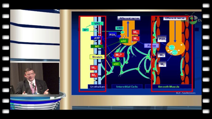Chris Chapple - "Современные достижения патофизиологии и фармакологического и оперативного лечения Гиперактивного Мочевого Пузыря (ГАМП)"