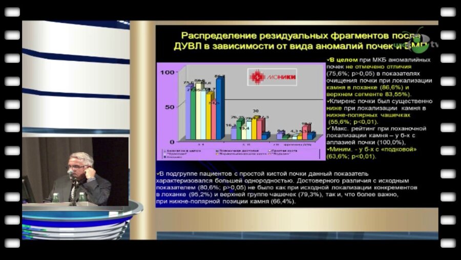 Дутов В.В. - "Интегративные подходы к диагностике и малоинвазивному лечению мочекаменной болезни аномалийных почек у взрослых и детей"