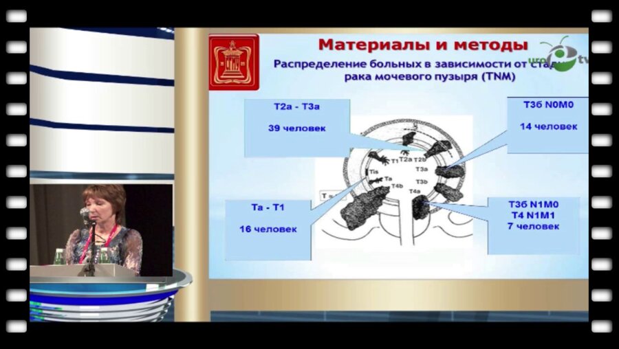 Маслякова Г.Н., Захарова Н.Б - "Молекулярно-биологические и иммуногистохимические онкомаркеры в диагностике и прогнозировании результатов лечения рака мочевого пузыря"
