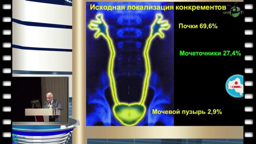 Дутов В.В. - "Новые подходы к медикаментозному лечению камней мочеточника"