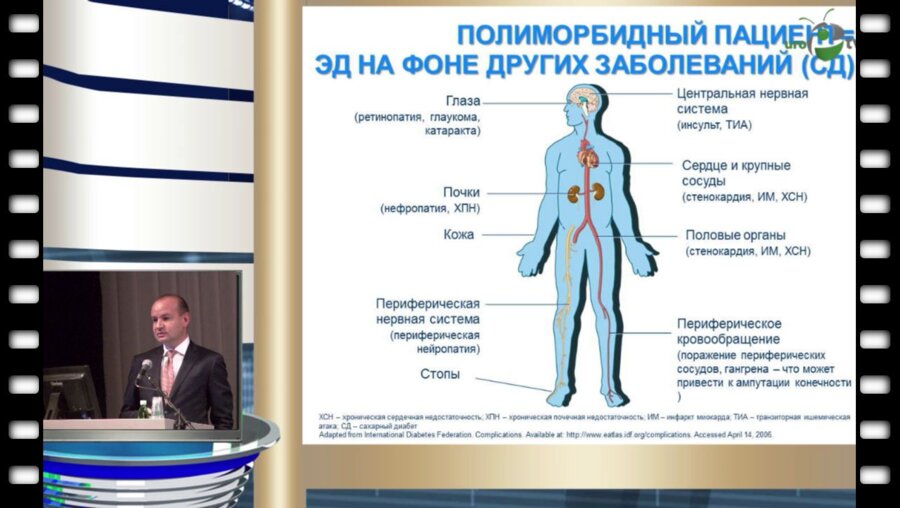 Зырянов С.К. - "Терапия ингибиторами ФДЭ5 у пациентов с различными соматическими заболеваниями"