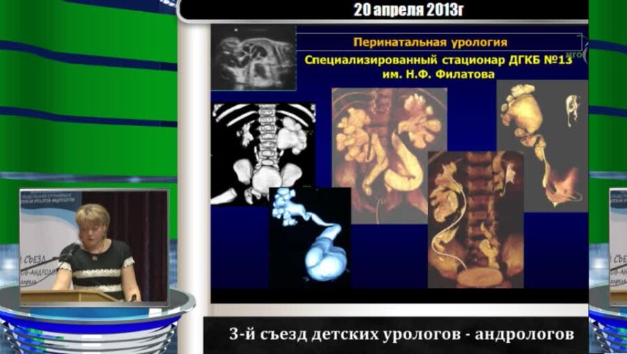 Левитская М.В. "Перинатальная урология. Итоги и перспективы"