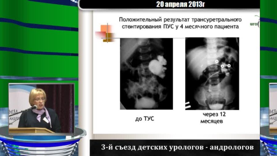 Ростовская В.В. "Новые знания об уродинамике лоханки в норме и при пренатально диагностированном гидронефрозе"