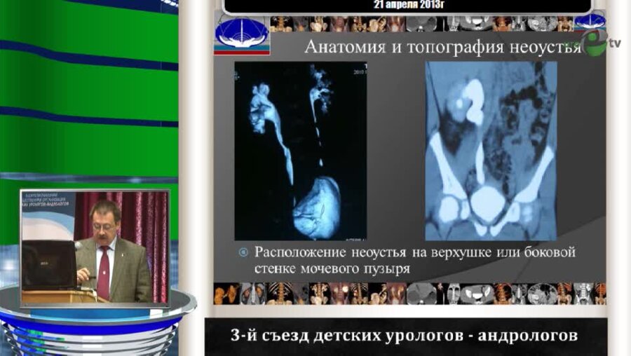 Павлов А.Ю. "Заболевания уретеро-везикального соустья новые технологии диагностики и выбор метода лечения"