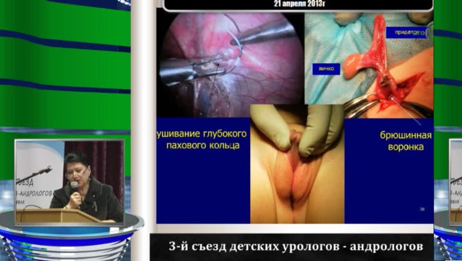 Володько Е.А. "Исходы лечения врожденных заболеваний органов репродуктивной системы"