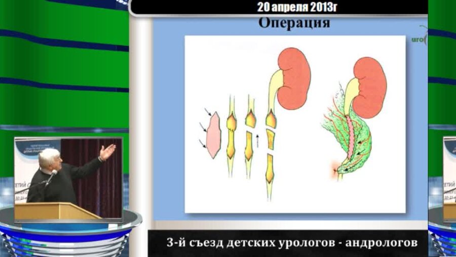 Коган М.И. "От противоречивых суждений к расширению знаний в детской и взрослой урологии"