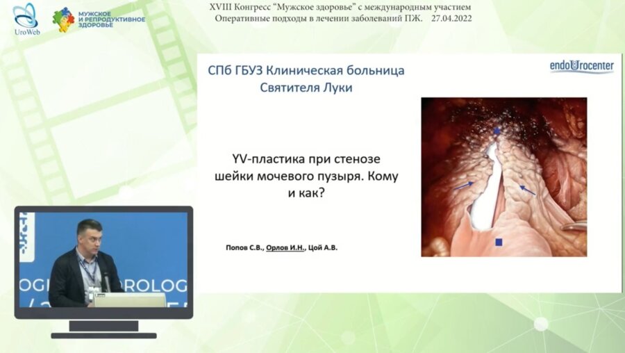 Орлов И.Н. - YV-пластика при стенозе шейки мочевого пузыря. Кому и как?