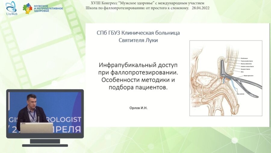 Орлов И.Н. - Инфрапубикальный доступ при фаллопротезировании. Особенности методики и подбора пациентов
