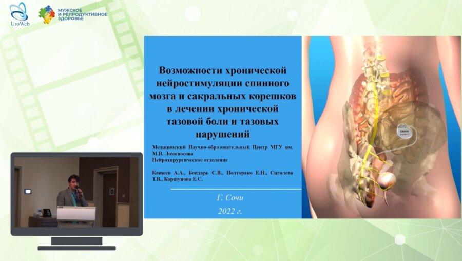 Кащеев А.А. - Возможности хронической нейростимуляции спинного мозга и сакральных корешков в лечении хронической тазовой боли и тазовых нарушений