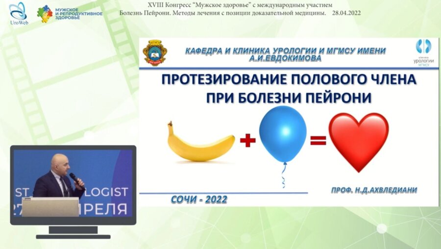 Ахвледиани Н.Д. - Протезирование полового члена при болезни Пейрони