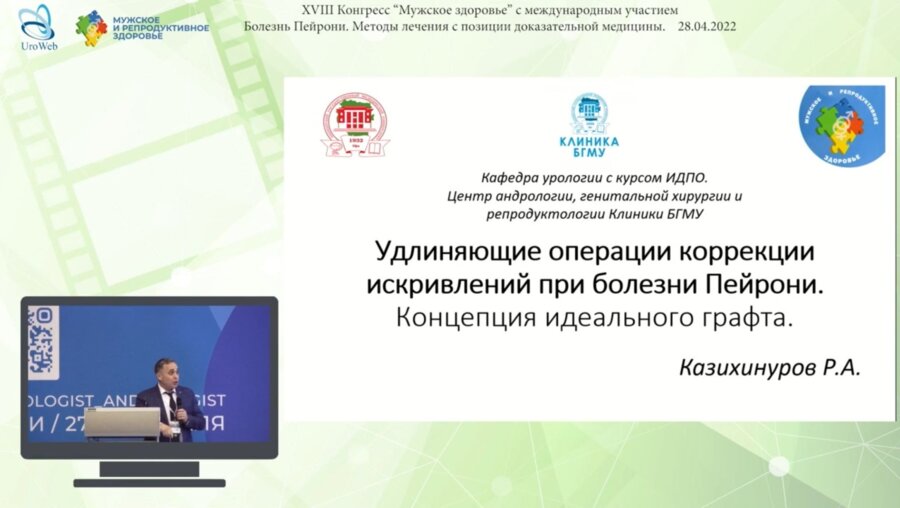 Казихинуров Р.А. - Удлиняющие операции коррекции искривлений при болезни Пейрони. Концепция идеального графта